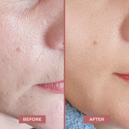 PDRN Collagen Glow Stick