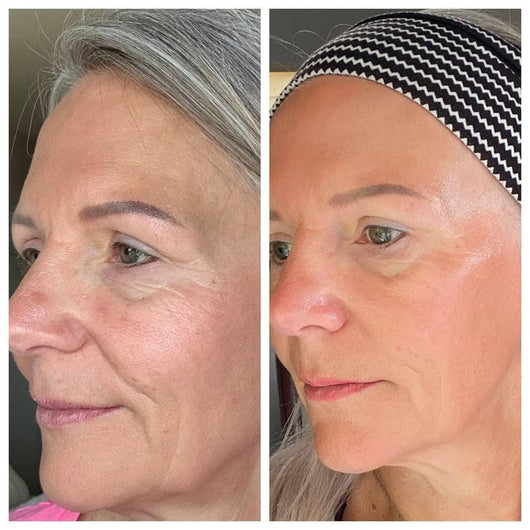 Lymphatic Sculpt Brush