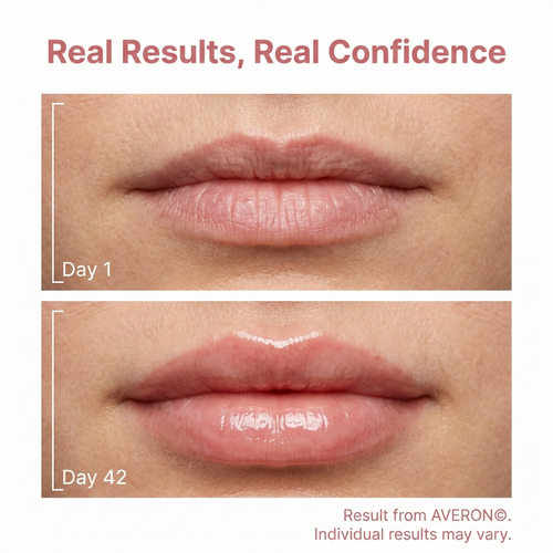 Averon™ 4 Wavelength LED Lip Therapy