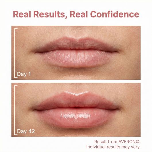 Averon™ 4 Wavelength LED Lip Therapy