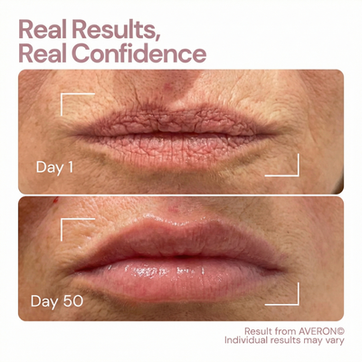 Averon™ 4 Wavelength LED Lip Therapy