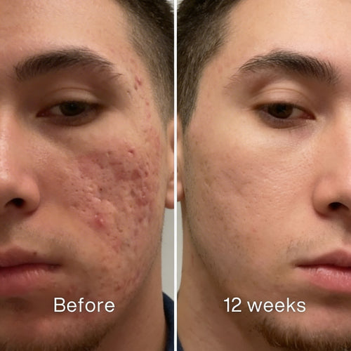 DermalSeal Recovery Stick